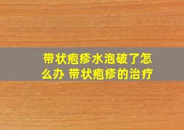 带状疱疹水泡破了怎么办 带状疱疹的治疗